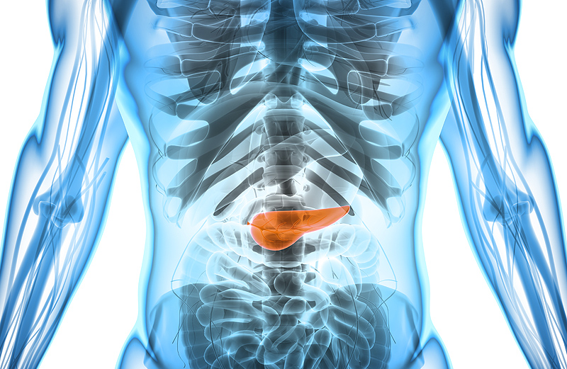 Pancreatic cancer and new therapeutic scenarios